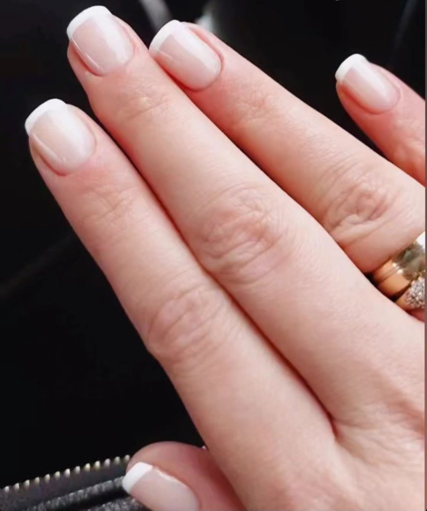 MANI 