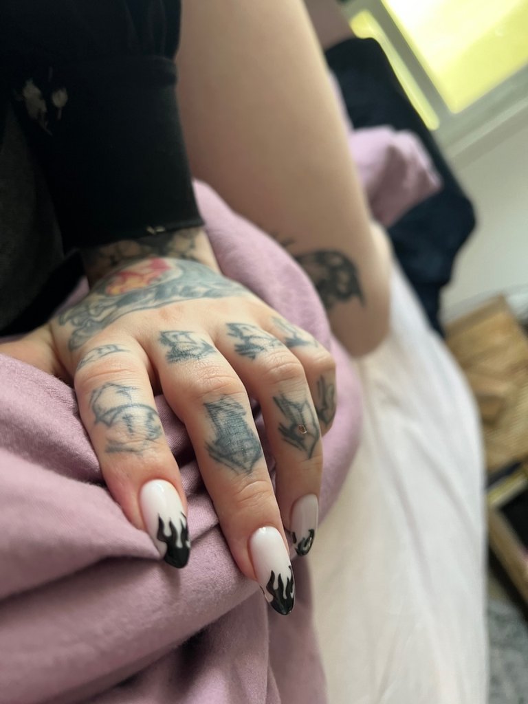 X