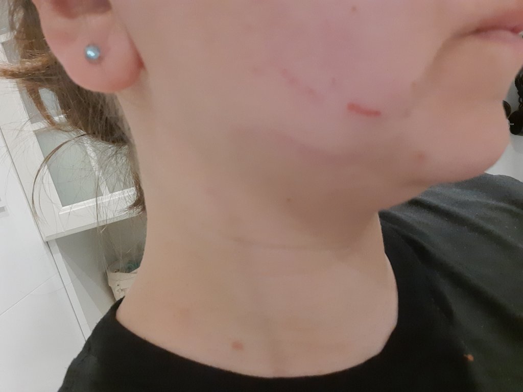 ..